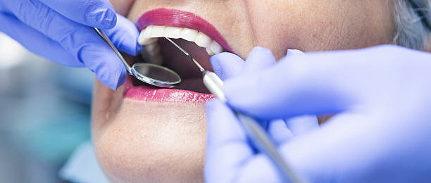 Best Knocked-Out Tooth (Avulsed Tooth) Treatment in Luxemburg, WI